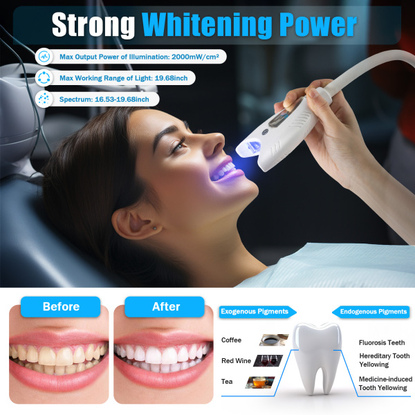 Best CNCEST Teeth Whitening Machine Dental Mobile Lamp Bleaching LED Light Accelerator
